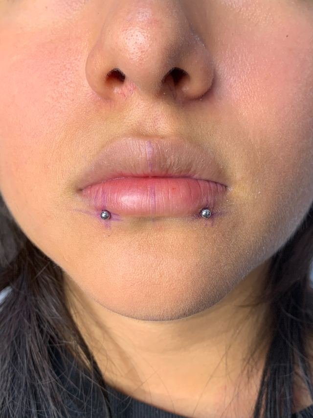 Perforaciones Snike Bites